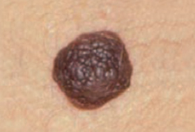 B&eacute;nin 10a