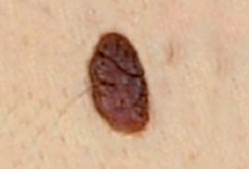 B&eacute;nin 11a