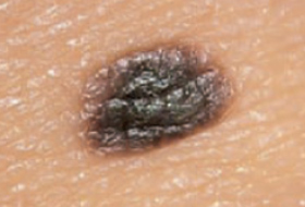 B&eacute;nin 9b